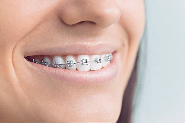 Laser Dentistry in Cedartown, GA